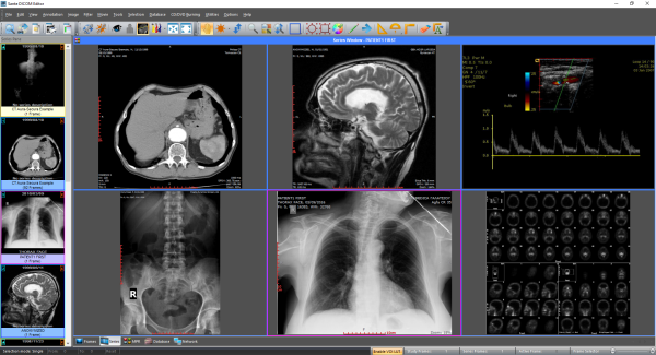 Sante DICOM Editor